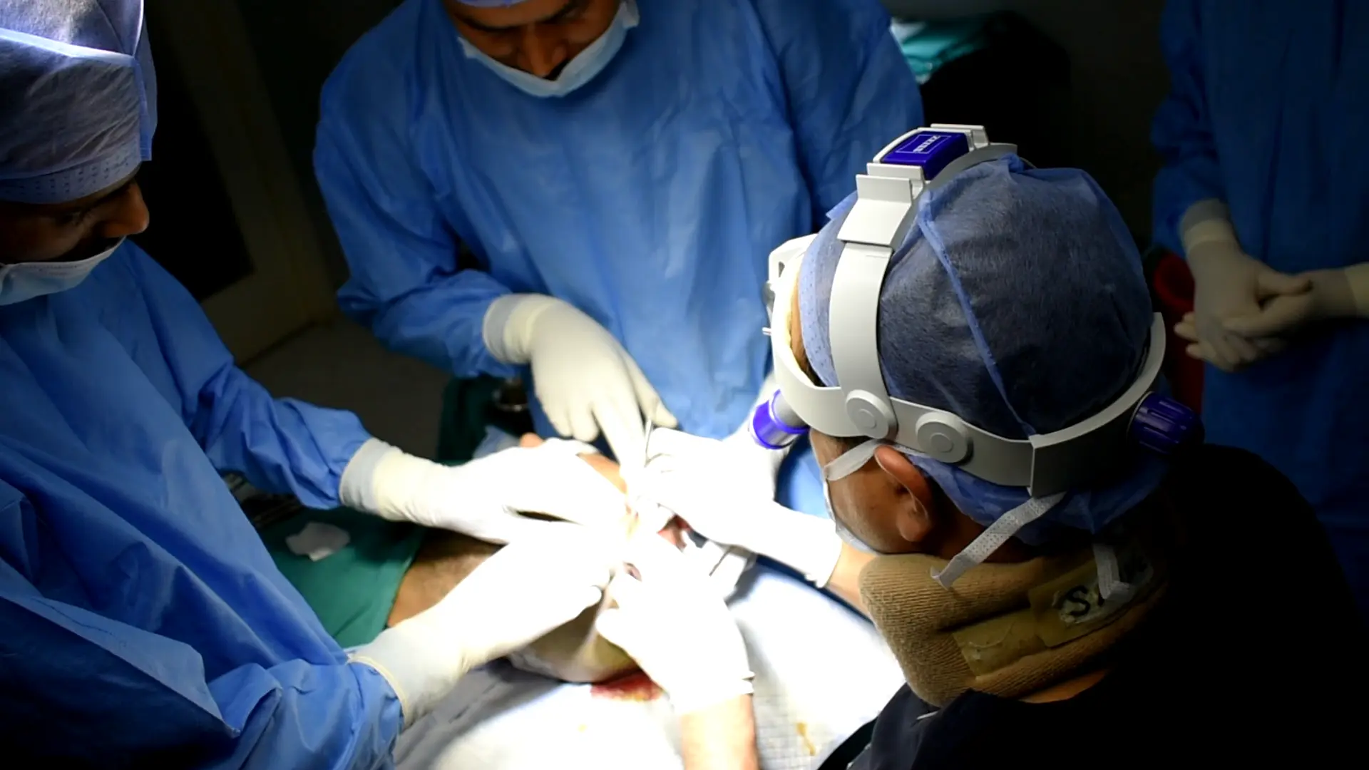 Hair transplant clinic in Delhi - IHT India patient consultation