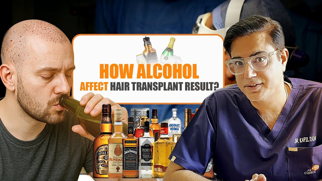 Can You Drink After a Hair Transplant?
