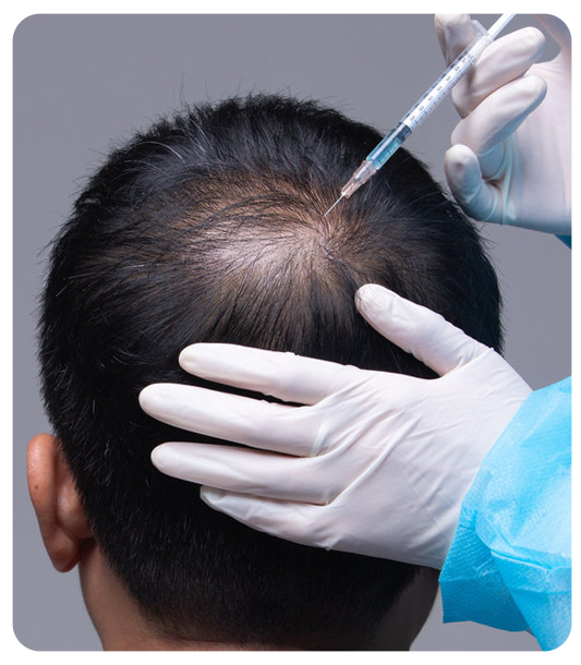 PRP hair treatment safety and results